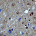 Immunohistochemistry of PACS1 in mouse brain tissue with PACS1 antibody at 2 μg/ml.