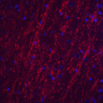 Immunofluorescence of PACS2 in mouse brain tissue with PACS2 antibody at 20 μg/ml.<br><br>Red: PACS2 Antibody (8189) <br> Blue: DAPI staining