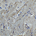 Immunohistochemistry of PACS2 in mouse brain tissue with PACS2 antibody at 5 μg/mL.