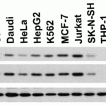 <strong>Figure 2 Independent Antibody Validation (IAV) via Protein Expression Profile in Cell Lines</strong><br>Loading: 15 μg of lysates per lane.Antibodies: PAK2  3885 (1 μg/mL), PAK2  3887 (1 μg/mL) and beta-actin (1 μg/mL), 1h incubation at RT  in 5% NFDM/TBST.Secondary: Goat anti-rabbit IgG HRP conjugate at 1:10000 dilution.
