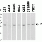 <strong>Figure 3 Western Blot Validation in Human, Mouse and Rat Cell Lines</strong><br>Loading: 15 μg of lysates per lane.Antibodies: PAK2  3885 (1 μg/mL per lane), 1h incubation at RT in 5% NFDM/TBST.Secondary: Goat anti-rabbit IgG HRP conjugate at 1:10000 dilution.