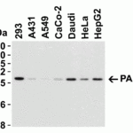 <strong>Figure 3 Western Blot Validation in Human Cell Lines</strong><br>Loading: 15 μg of lysates per lane.Antibodies: PAK2  3887 (1 μg/mL), 1h incubation at RT in 5% NFDM/TBST.Secondary: Goat anti-rabbit IgG HRP conjugate at 1:10000 dilution.
