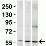 <strong>Figure 4 Western Blot Validation in Mouse Tissues</strong><br>Loading: 15 μg of lysates per lane.Antibodies: PAK2  3887 (1 μg/mL per lane), 1h incubation at RT in 5% NFDM/TBST.Secondary: Goat anti-rabbit IgG HRP conjugate at 1:10000 dilution.