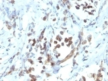 PAX6 Antibody [PAX6/1166]