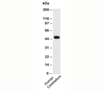 PAX6 Antibody [PAX6/498]