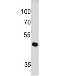 PAX7 Antibody [PAX7/497]