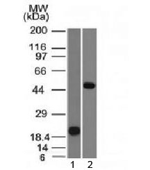 PAX8 Antibody [PAX8/1491]