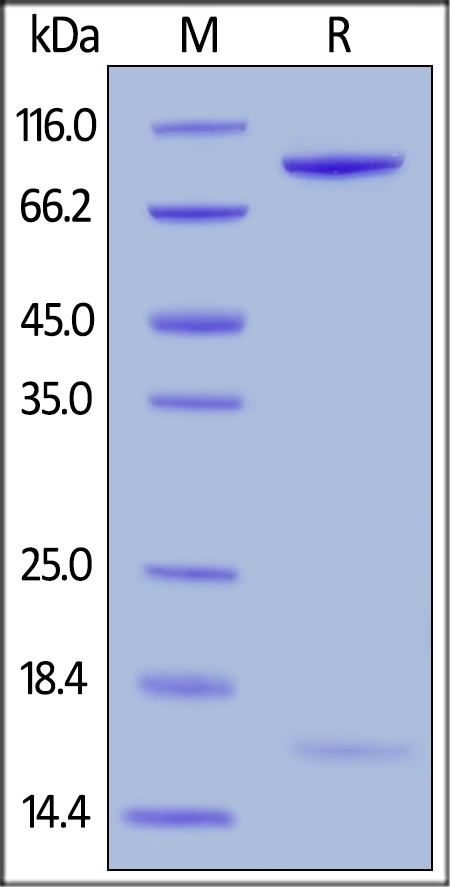 PCSK9 Recombinant Protein