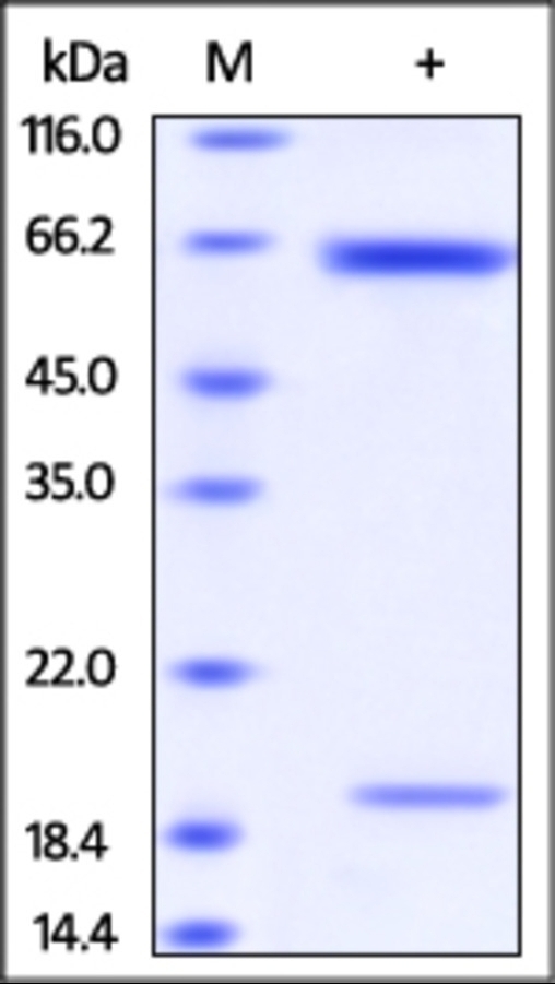 PCSK9 Recombinant Protein