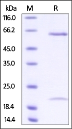 PCSK9 Recombinant Protein