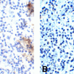 (A) Immunohistochemistry of PD-1 in human spleen tissue with PD-1 [10B3] antibody at 10 μg/mL. (B) Immunohistochemistry in human spleen tissue with control mouse IgG staining at 10 μg/mL.