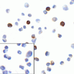 Immunocytochemistry of PD-1 in transfected 293 cells with PD-1 [4C7] antibody at 10 μg/mL. Lower left: Immunocytochemistry in transfected 293 cells with control mouse IgG antibody at 10 μg/mL.