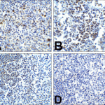 Immunohistochemistry of PD-1 in (A) human tonsil tissue, (B) human lymph node tissue, and (C) human spleen tissue with PD-1 antibody at 5 μg/mL. (D) Immunohistochemistry in human tonsil tissue with control mouse IgG staining at 5 μg/mL.