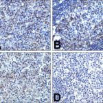 Immunohistochemistry of PD-1 in (A) human tonsil tissue, (B) human lymph node tissue, and (C) human spleen tissue with PD-1 antibody at 5 μg/mL. (D) Immunohistochemistry in human tonsil tissue with control mouse IgG staining at 5 μg/mL.