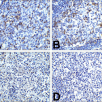 Immunohistochemistry of PD-1 in (A) human tonsil tissue, (B) human lymph node tissue, and (C) human spleen tissue with PD-1 antibody at 5 μg/mL. (D) Immunohistochemistry in human tonsil tissue with control mouse IgG staining at 5 μg/mL.