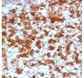 PD-1 Antibody [PD203-1]