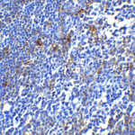 <strong>Figure 6 Immunohistochemistry Validation of PD-1 in Human Tonsil Tissue </strong><br> Immunohistochemical analysis of paraffin-embedded human tonsil tissue using anti-PD-1 antibody (4065) at 5 μg/ml. Tissue was fixed with formaldehyde and blocked with 10% serum for 1 h at RT; antigen retrieval was by heat mediation with a citrate buffer (pH6). Samples were incubated with primary antibody overnight at 4°C. A goat anti-rabbit IgG H&L (HRP) at 1/250 was used as secondary. Counter stained with Hematoxylin.