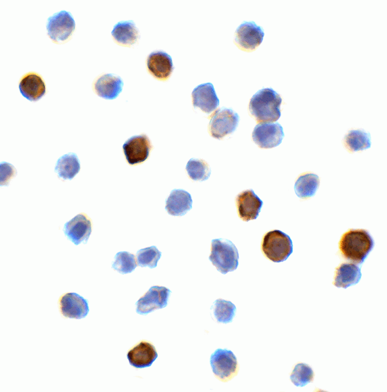 PDL1 Antibody [5H6]