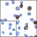 Immunocytochemistry of PD-L1 in transfected HEK293 cells with PD-L1 antibody at 1 μg/mL. Lower left: Immunocytochemistry in transfected HEK293 cells with control mouse IgG antibody at 1 μg/mL.