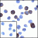 Immunocytochemistry of PD-L1 in transfected HEK293 cells with PD-L1 antibody at 1 μg/mL. Lower left: Immunocytochemistry in transfected HEK293 cells with control mouse IgG antibody at 1 μg/mL.