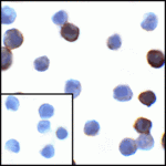 <strong> Figure 10 Immunocytochemistry Validation of PD-L1 in PD-L1 Overexpressed 293 Cells </strong><br>Immunocytochemical analysis of PD-L1 transfected 293 cells using anti- PD-L1 antibody (RF16035) at 1 μg/mL. Cells was fixed with formaldehyde and blocked with 10% serum for 1 h at RT; antigen retrieval was by heat mediation with a citrate buffer (pH6). Samples were incubated with primary antibody overnight at 4° C. A goat anti-rabbit IgG H&L (HRP) at 1/250 was used as secondary. Counter stained with Hematoxylin.  Lower left: Use mouse IgG antibody at 1 μg/mL  as control.