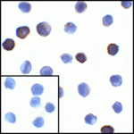 Immunocytochemistry of PD-L1 in transfected HEK293 cells with PD-L1 antibody at 1 μg/mL. Lower left: Immunocytochemistry in transfected HEK293 cells with control mouse IgG antibody at 1 μg/mL.