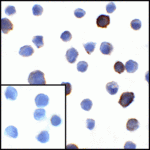 Immunocytochemistry of PD-L1 in transfected HEK293 cells with PD-L1 antibody at 1 μg/mL. Lower left: Immunocytochemistry in transfected HEK293 cells with control mouse IgG antibody at 1 μg/mL.
