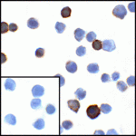 Immunocytochemistry of PD-L1 in transfected HEK293 cells with PD-L1 antibody at 1 μg/mL. Lower left: Immunocytochemistry in transfected HEK293 cells with control mouse IgG antibody at 1 μg/mL.