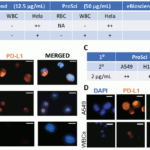 <strong>Figure 11 Immunofluorescence Validation of PD-L1 in tumors in Human Cells (Dhar et al., 2018) </strong><br>(A) Several antibody brands were first tested with RBCs, WBCs, and HeLa cells: BioLegend, ProSci, and eBioscience. <strong>ProSci (4059) was chosen as it provided the highest staining intensity</strong><br>. (B, C) Using the optimal conditions of anti-PDL1 (ProSci Inc) at a concentration of 50μg/mL, following by goat anti-rabbit Alexa Fluor 647, PDL-1 staining was tested on several lung cancer cell lines: A549 (adenocarcinoma), H1703 (adenocarcinoma), H3255 (squamous) and WBCs as a control. (D) Once validated, patient samples were stained for PD-L1, CK, CD45, DAPI.