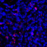 <strong>Figure 7 Immunofluorescence Validation of PD-L1 in Human Tonsil Tissue</strong><br> Immunofluorescent analysis of 4% paraformaldehyde-fixed human tonsil tissue labeling PD-L1 with RF16035 at 2 μg/mL, followed by goat anti-mouse IgG secondary antibody at 1/500 dilution (red) and DAPI staining (blue).