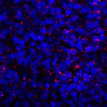 Immunofluorescence of PD-L1 in human tonsil tissue with PD-L1 antibody at 2 μg/mL. <br><br>Red: PDL1 Antibody [1D7] (RF16038) <br> Blue: DAPI staining