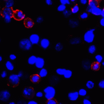 <strong>Figure 5 Immunofluorescence Validation of PD-L1 in Transfected 293 Cells</strong><br> Immunofluorescent analysis of 4% paraformaldehyde-fixed PD-L1 transfected 293 cells labeling PD-L1 with RF16035 at 2 μg/mL, followed by goat anti-mouse IgG secondary antibody at 1/500 dilution (red) and DAPI staining (blue).