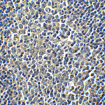 <strong>Figure 5 Immunohistochemistry Validation of PD-L1 in Human Tonsil Cells</strong><br> Immunohistochemical analysis of paraffin-embedded human tonsil tissue using anti-PD-L1 antibody (4059) at 5 μg/ml. Tissue was fixed with formaldehyde and blocked with 10% serum for 1 h at RT; antigen retrieval was by heat mediation with a citrate buffer (pH6). Samples were incubated with primary antibody overnight at 4°C. A goat anti-rabbit IgG H&L (HRP) at 1/250 was used as secondary. Counter stained with Hematoxylin.