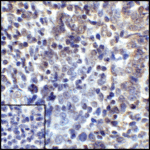 Immunohistochemistry of PD-L1 in human tonsil tissue with PD-L1 antibody at 5 μg/mL.