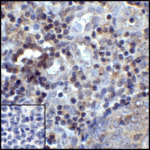 Immunohistochemistry of PD-L1 in human tonsil tissue with PD-L1 antibody at 5 μg/mL.