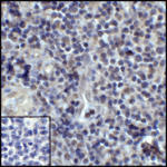 Immunohistochemistry of PD-L1 in human tonsil tissue with PD-L1 antibody at 5 μg/mL.