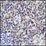 Immunohistochemistry of PD-L1 in human tonsil tissue with PD-L1 antibody at 5 μg/mL.
