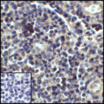 Immunohistochemistry of PD-L1 in human tonsil tissue with PD-L1 antibody at 5 μg/mL.