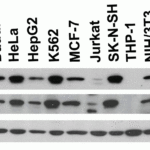 <strong>Figure 2 Independent Antibody Validation (IAV) via Protein Expression Profile in Cell Lines</strong><br>Loading: 15 μg of lysates per lane.Antibodies: 4059 (2 μg/mL), RF16035 (2 μg/mL), and beta-actin (1 μg/mL), 1 h incubation at RT in 5% NFDM/TBST.Secondary: Goat anti-rabbit and or anti-mouse IgG HRP conjugate at 1:10000 and 1:5000 dilution, respectively.