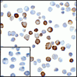 Immunocytochemistry of PD-L2 in transfected HEK293 cells with PD-L2 antibody at 5 μg/mL. Lower left: Immunocytochemistry in transfected HEK293 cells with control mouse IgG antibody at 5 μg/mL.
