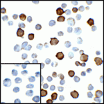 Immunocytochemistry of PD-L2 in transfected HEK293 cells with PD-L2 antibody at 5 μg/mL. Lower left: Immunocytochemistry in transfected HEK293 cells with control mouse IgG antibody at 5 μg/mL.