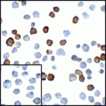 Immunocytochemistry of PD-L2 in transfected HEK293 cells with PD-L2 antibody at 5 μg/mL. Lower left: Immunocytochemistry in transfected HEK293 cells with control mouse IgG antibody at 5 μg/mL.