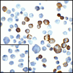 Immunocytochemistry of PD-L2 in transfected HEK293 cells with PD-L2 antibody at 5 μg/mL. Lower left: Immunocytochemistry in transfected HEK293 cells with control mouse IgG antibody at 5 μg/mL.