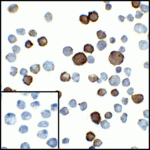 Immunocytochemistry of PD-L2 in transfected HEK293 cells with PD-L2 antibody at 5 μg/mL. Lower left: Immunocytochemistry in transfected HEK293 cells with control mouse IgG antibody at 5 μg/mL.