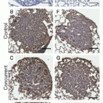 <strong>Figure 9  Immunohistochemistry Validation of PD-L2 in Lung Tumor of Mice (Kao et al., 2015) </strong><br>Protein analysis for PD-L2 (E-H)  by immunohistochemistry with anti-PD-L2 antibodies  in mice lung tumors. hMUC1.Tg mice were induced with lung adenoma and then treated with  concurrent or sequential cisplatin/radiotherapy.  PD-L2 expression level at week 41 after treatment was similar in control and treatment groups.
