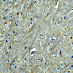 <strong>Figure 7 Immunohistochemistry Validation of PD-L2 in Mouse Brain Tissue </strong><br> Immunohistochemical analysis of paraffin-embedded mouse brain tissue using anti-PD-L2 antibody (4063) at 2.5 μg/ml. Tissue was fixed with formaldehyde and blocked with 10% serum for 1 h at RT; antigen retrieval was by heat mediation with a citrate buffer (pH6). Samples were incubated with primary antibody overnight at 4°C. A goat anti-rabbit IgG H&L (HRP) at 1/250 was used as secondary. Counter stained with Hematoxylin.