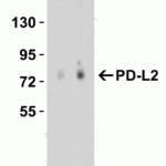 <strong>Figure 3 KO Validation in HeLa Cells</strong><br> Loading: 15 μg of HeLa WT cell lysates or PD-L2 KO cell lysates. Antibodies:  PD-L2, 4063 (4 μg/mL) and beta-actin 3779 (1 μg/mL), 1 h incubation at RT in 5% NFDM/TBST.Secondary: Goat Anti-Rabbit IgG HRP conjugate at 1:10000 dilution.