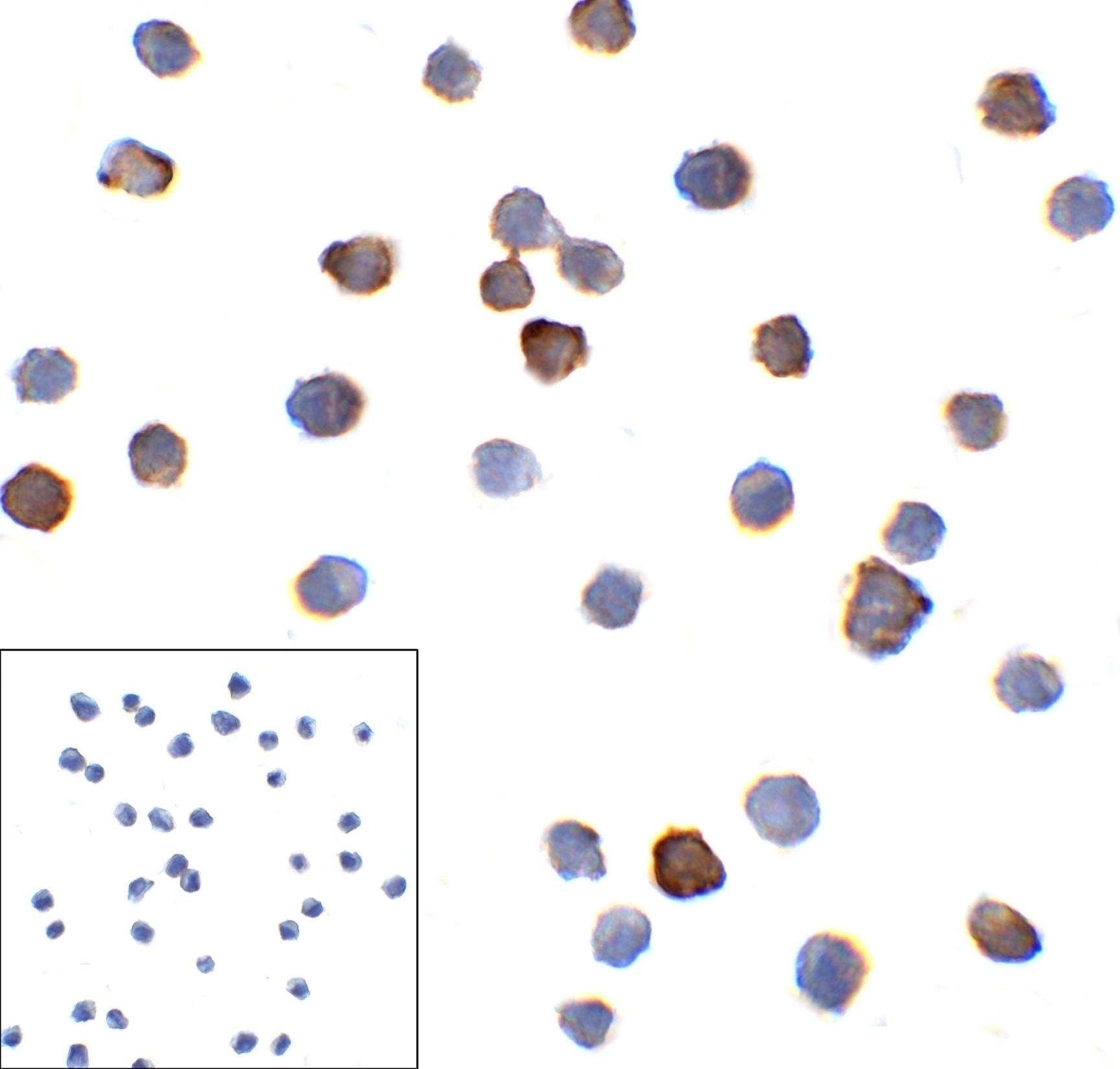 PD1 Antibody [5D3]