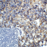 Immunohistochemistry of PD-1 in human lymph node tissue with PD-1 antibody at 5 μg/mL. Corner Box: Immunocytochemistry in transfected 293 cells with control mouse IgG antibody at 10 μg/mL.