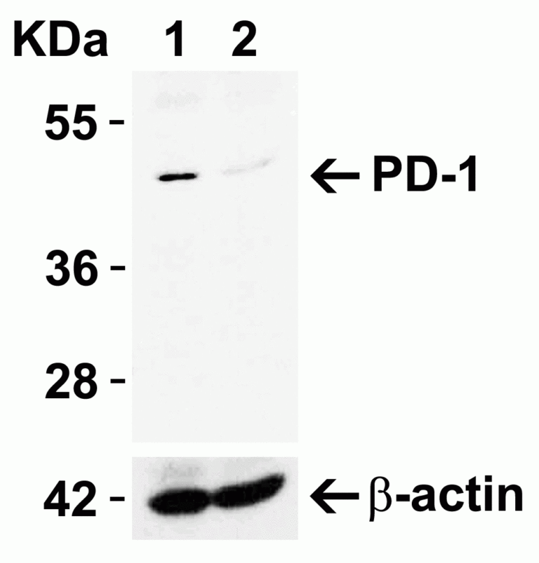 PD-1 Antibody